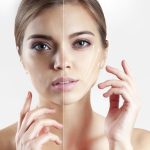 5 Wholesome Methods To Carry The Sagging Pores and skin On Face