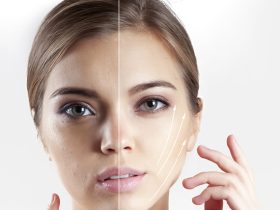 5 Wholesome Methods To Carry The Sagging Pores and skin On Face