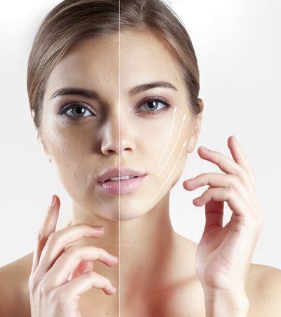 5 Wholesome Methods To Carry The Sagging Pores and skin On Face