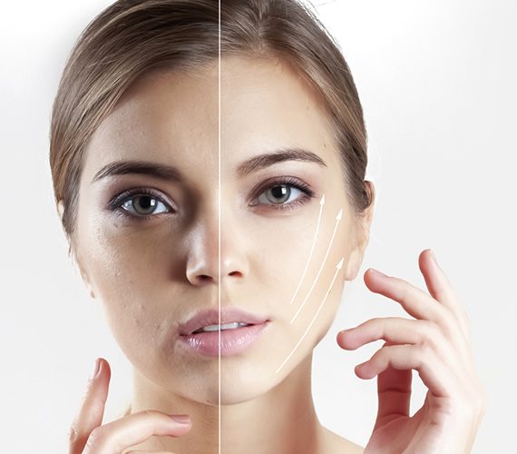 5 Wholesome Methods To Carry The Sagging Pores and skin On Face