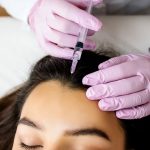 Mesotherapy For Hair Loss – Does It Work?