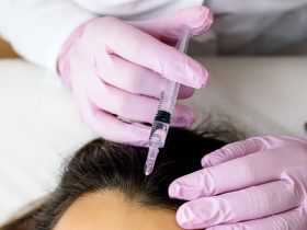Mesotherapy For Hair Loss – Does It Work?