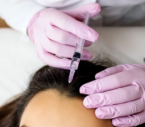 Mesotherapy For Hair Loss – Does It Work?